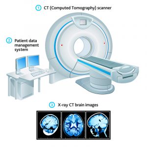 CT Scan Illustration at Green Imaging