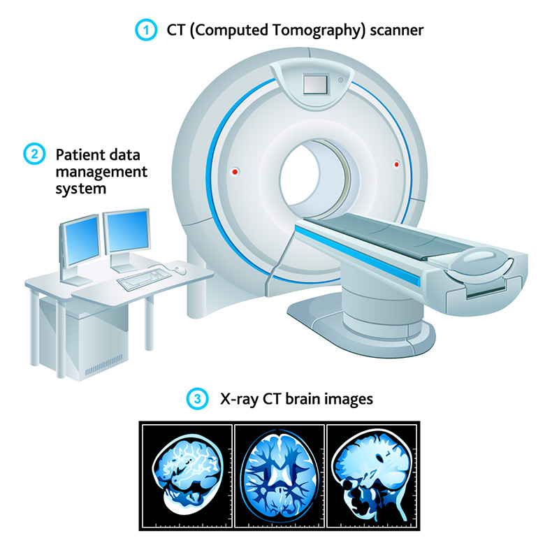 CT scanner shortage puts lives at risk
