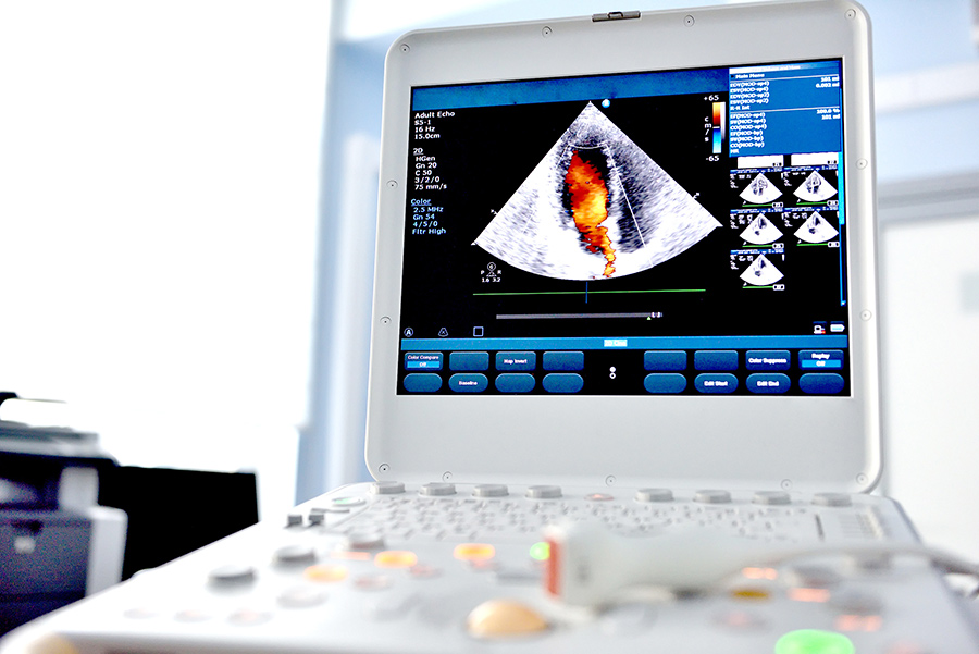 greenimaging-ultrasound-survey-of-the-heart