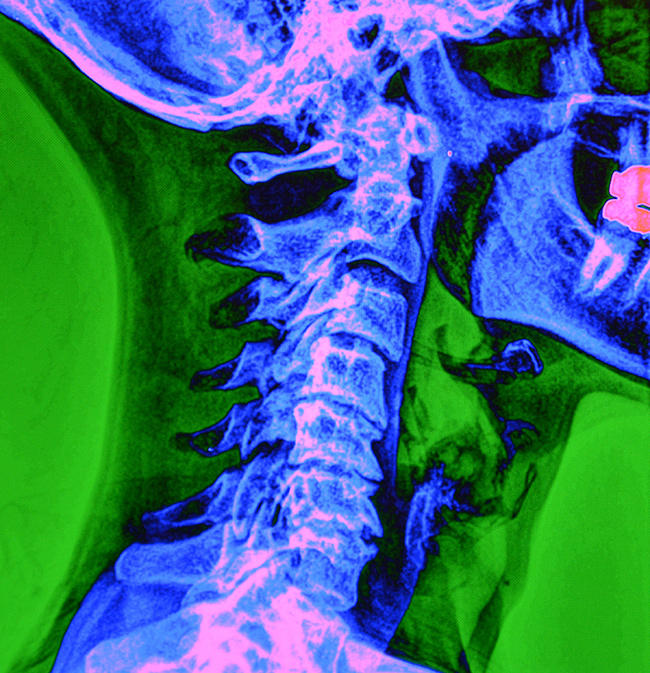 Green Imaging spinal X-ray