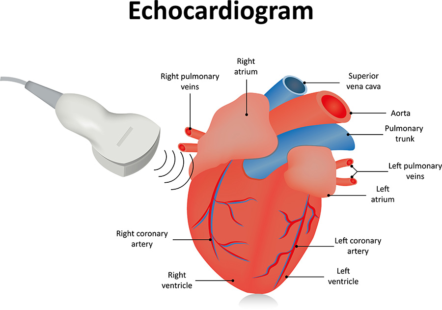 Echocardiogram | Green Imaging