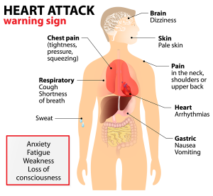 5 Signs of A Heart Attack