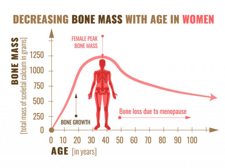 Bone Density - Green Imaging - Affordable MRIs, CT Scan, Mammogram