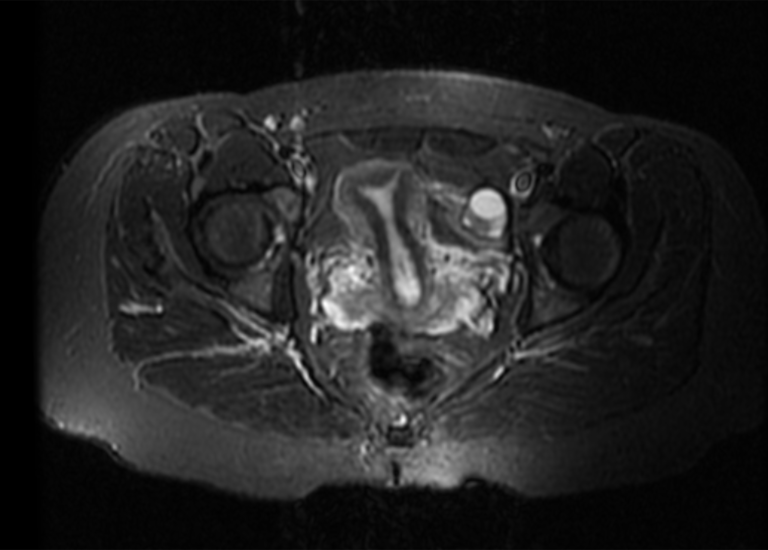 Pelvic MRI - Green Imaging - Affordable MRIs, CT Scan, Mammogram